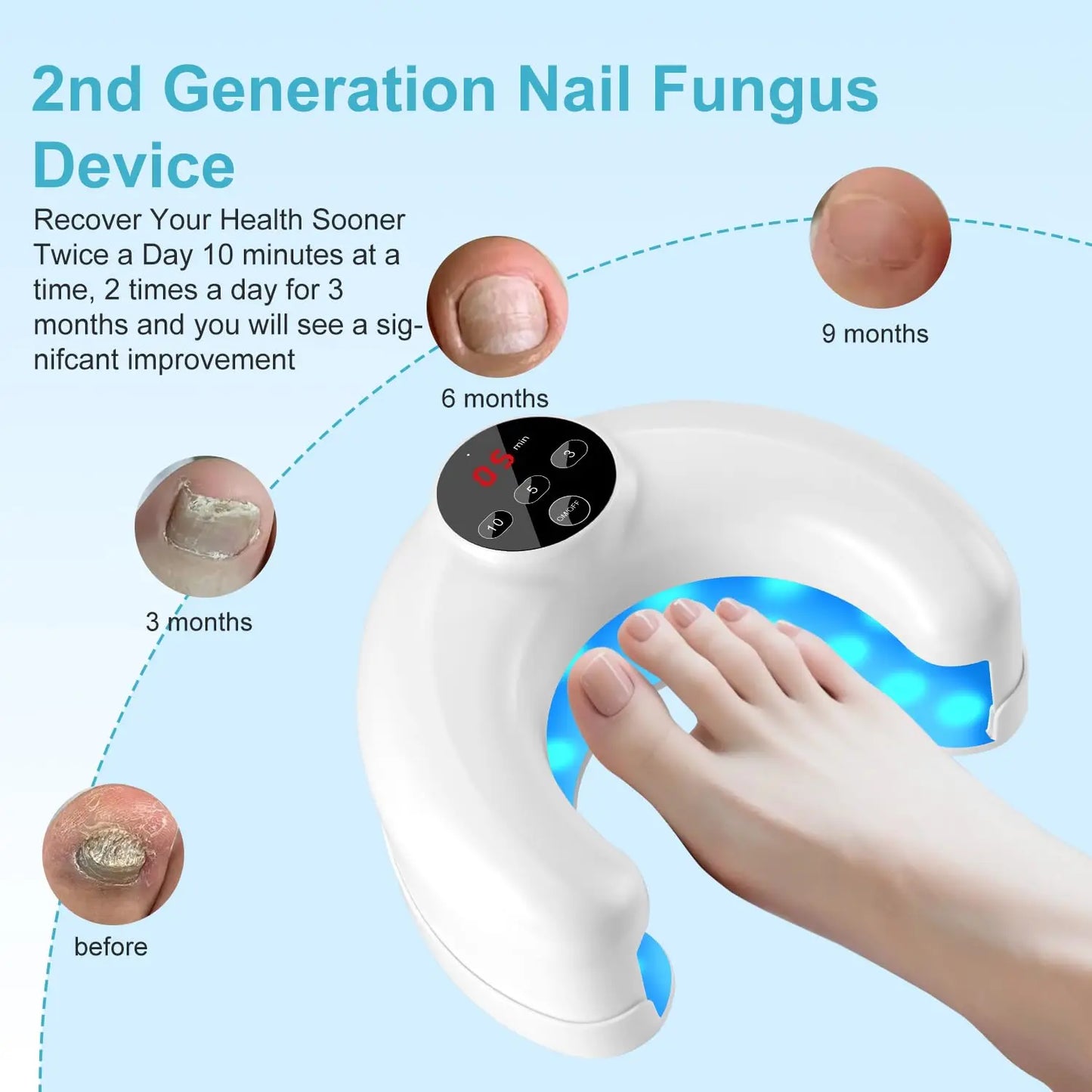 Wireless Nail Fungus & Ingrown Toenail Treatment Device – 45W LED Therapy