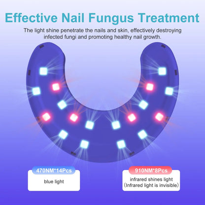 Wireless Nail Fungus & Ingrown Toenail Treatment Device – 45W LED Therapy